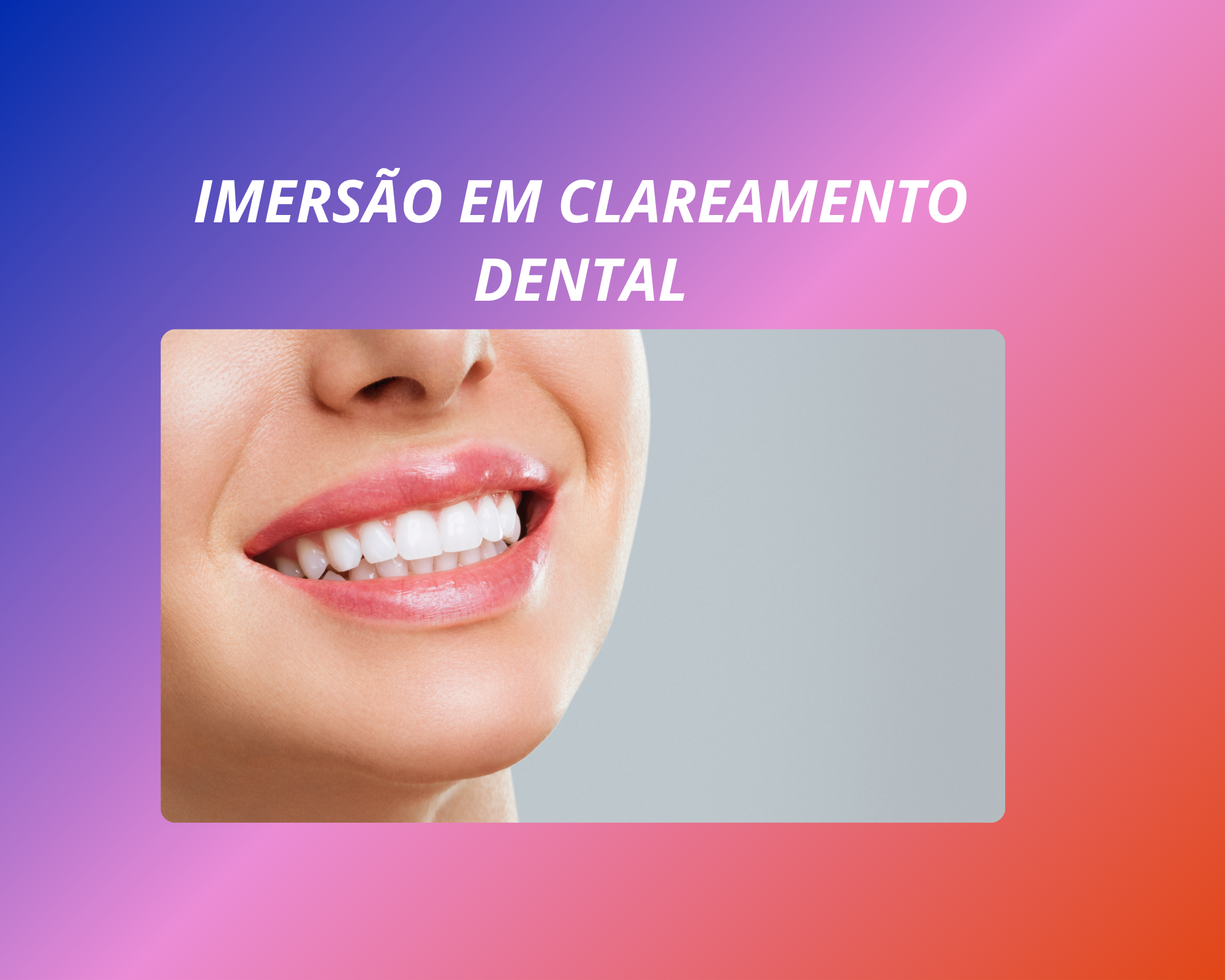 Curso de Imersão em Clareamento Dental 2026/1