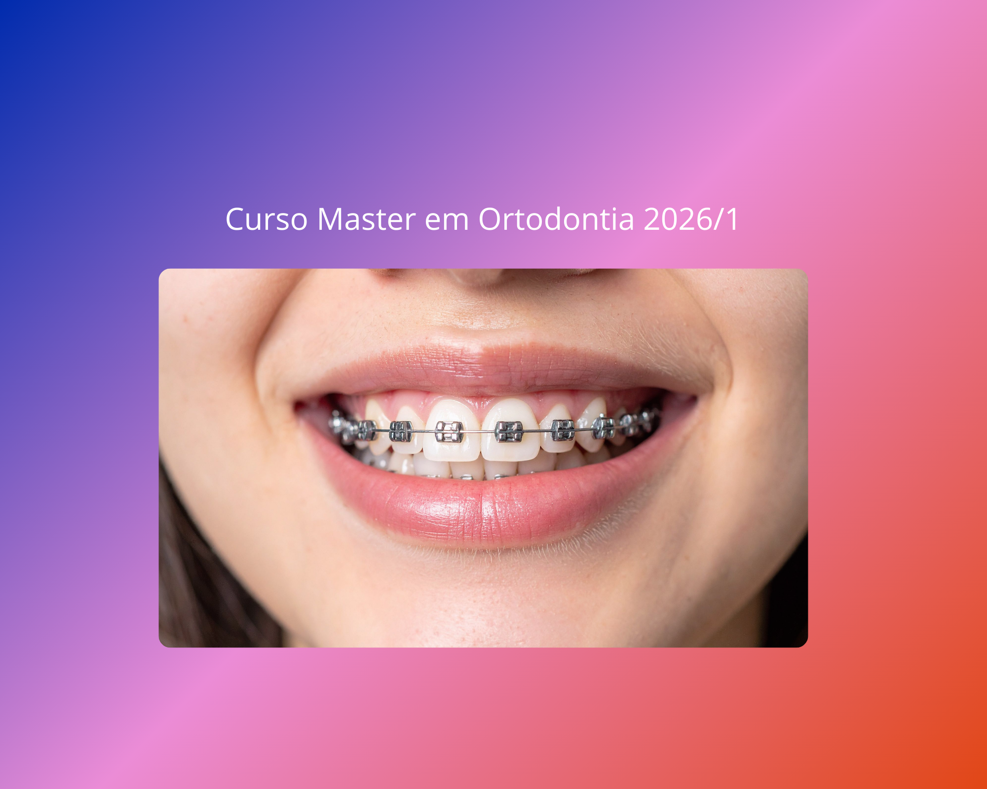 Curso Master em Ortodontia