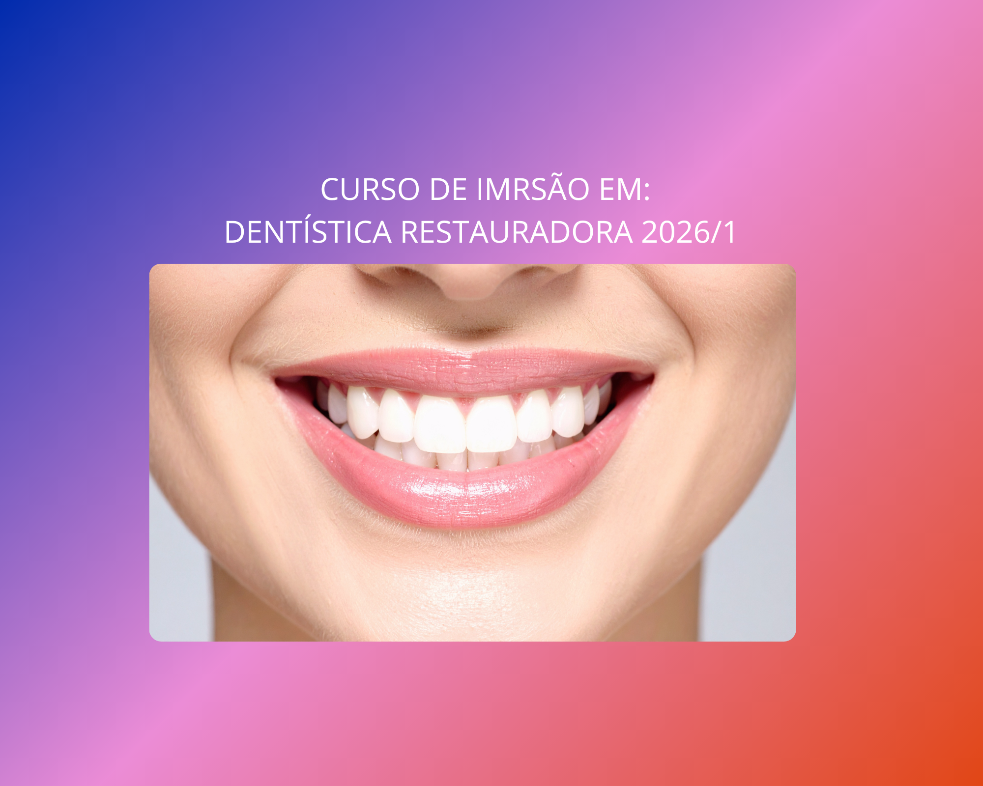 Curso de Imersão em: Dentística Restauradora