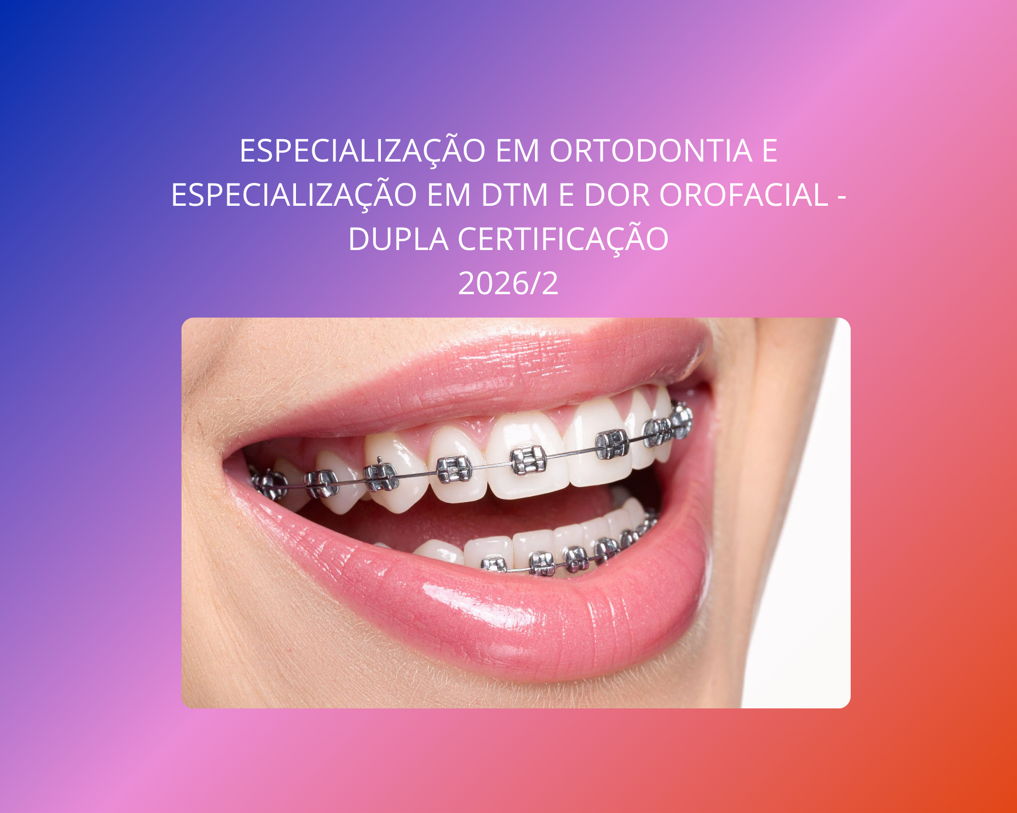 ESPECIALIZAÇÃO EM ORTODONTIA E ESPECIALIZAÇÃO EM DTM E DOR OROFACIAL – DUPLA CERTIFICAÇÃO